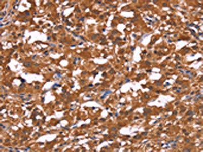 HLTF Antibody