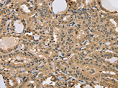 CENPV Antibody