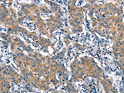 CRIM1 Antibody