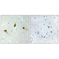 MSH2 Antibody