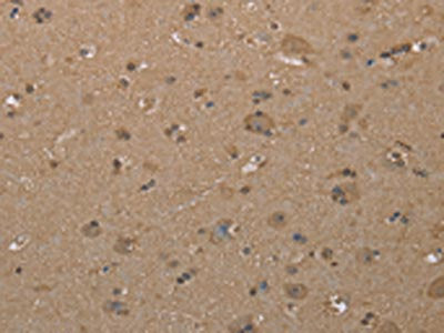 CAB39 Antibody