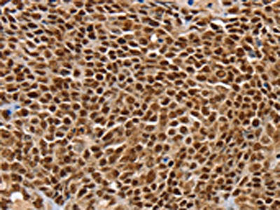 SSX5 Antibody