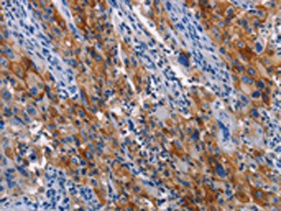 ICAM1 Antibody
