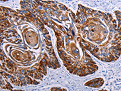 DEFA1 Antibody