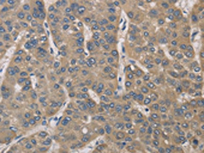 IRAK4 Antibody