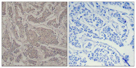 SMAD3 (Ab-425) Antibody