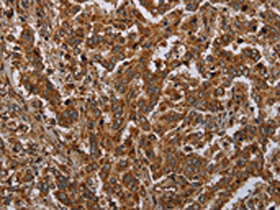 ATP2A1 Antibody