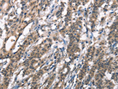 DGAT1 Antibody