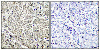 Phospho-RELA (Ser529) Antibody