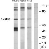 GRK5 Antibody