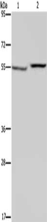PHGDH Antibody