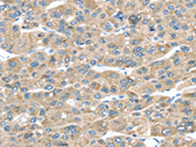 TMED2 Antibody