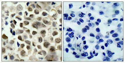 Phospho-HDAC8 (Ser39) Antibody