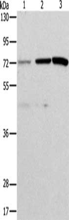 ALS2CR11 Antibody