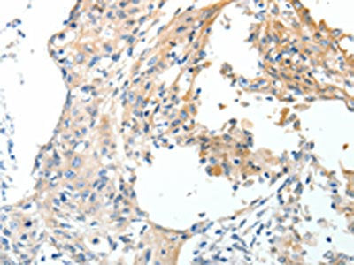 STEAP4 Antibody