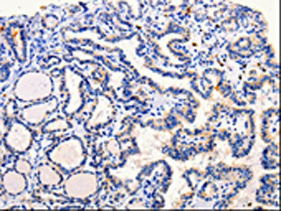 ARL6 Antibody