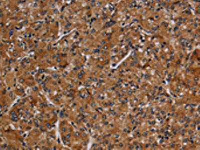 MMP9 Antibody