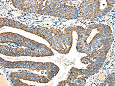 NDUFA5 Antibody