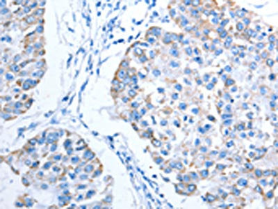 ALAS1 Antibody