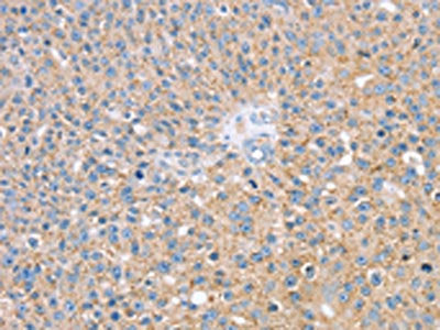 SMAGP Antibody