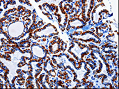 ARL6 Antibody