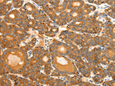 SCT Antibody
