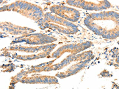 PRDX3 Antibody