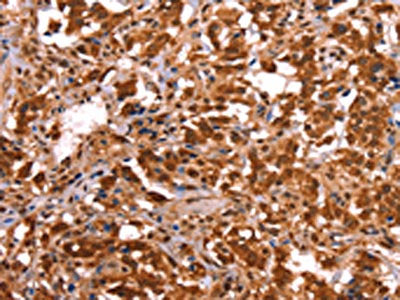 ESRRB Antibody