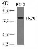 PRKCQ (Ab-676) Antibody