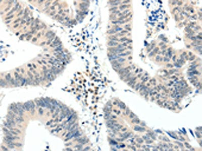 TRAF7 Antibody