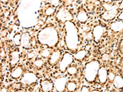 AGPAT9 Antibody