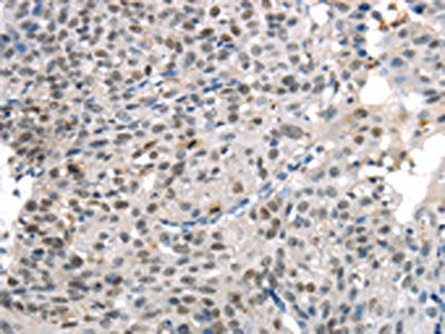 KDM5C Antibody