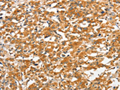 ANKMY2 Antibody