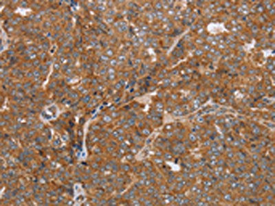 NDUFS2 Antibody