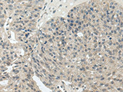 STRA6 Antibody