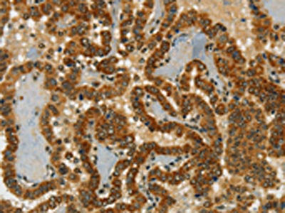 CHRDL2 Antibody