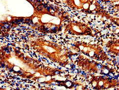 TLK2 Antibody