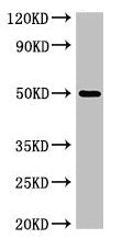SGMS1 Antibody