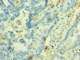 STX12 Antibody
