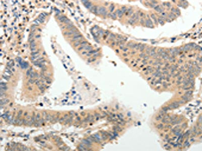 ADAMTS2 Antibody