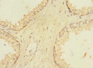 VN1R5 Antibody