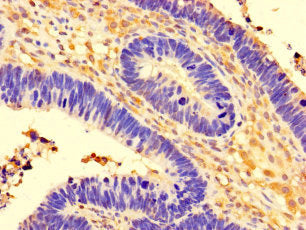 CCDC91 Antibody