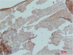 PRKAA1 Antibody
