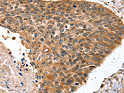 HOXB1 Antibody