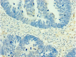 MEF2C Antibody