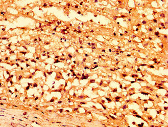 SENP7 Antibody