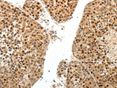SPATA2L Antibody