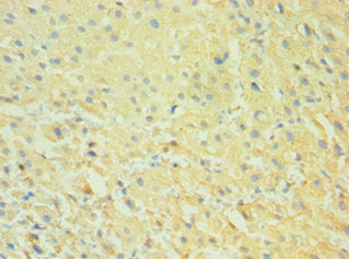 CALHM1 Antibody