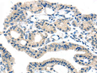 SLC16A11 Antibody
