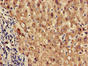 TPH2 Antibody